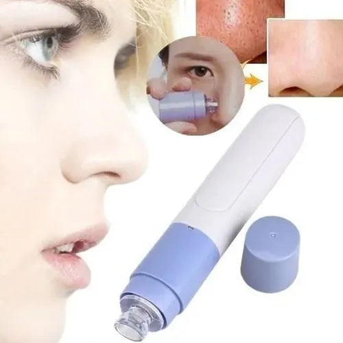 Extractor De Espinillas Y Puntos Negros